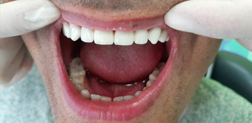 Лечение зубов без боли тюмень