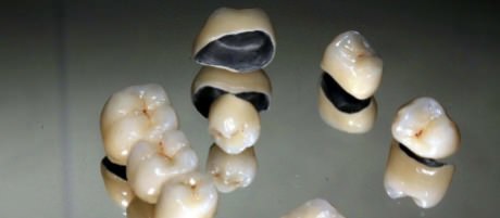 Металлокерамические коронки на зубы фото