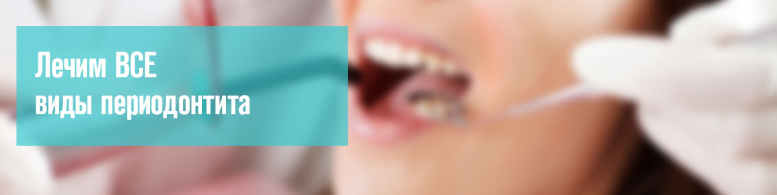 Лечение периодонтита зуба в Тюмени