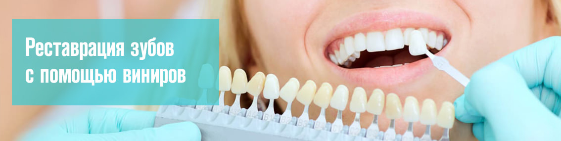 Восстановление зубов в стоматологии